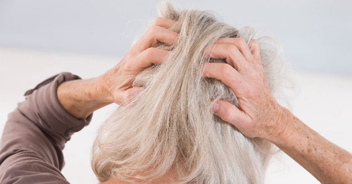 See Pics and Treatment - Psoriasis