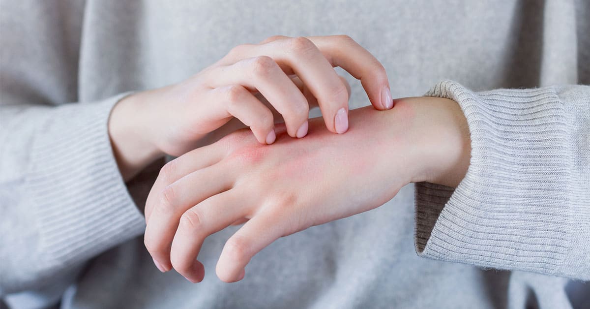 Understanding plaque psoriasis: A critical guide to  Seniors' health